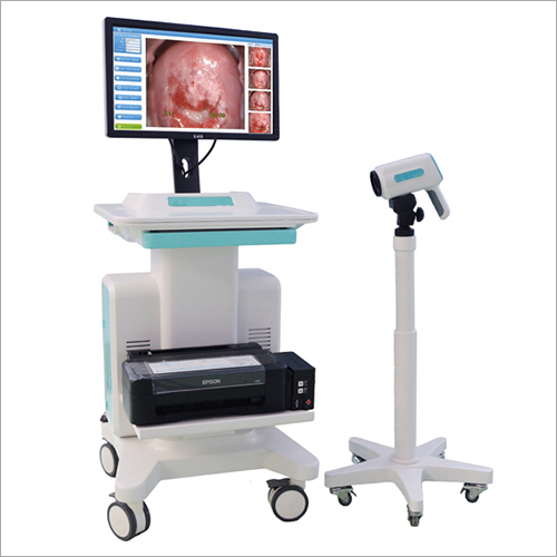 Colposcope