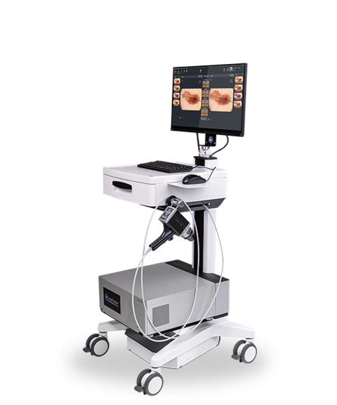 Foto Finder Dermoscope